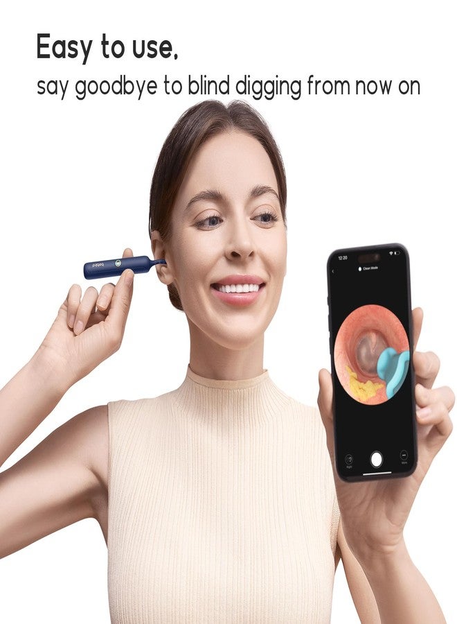 BEBIRD Official Original Accessory Only for Earsight Plus or R1 Ultra- 14 PCS Replacement Tip for Wet/Dry Wax Cleaning - Ear Spoons Accessories Set (New Spiral Structure!) - Image 5